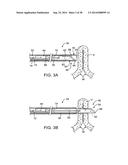 APPARATUS AND METHODS FOR POSITIONING AND SECURING ANCHORS diagram and image