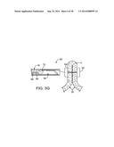 APPARATUS AND METHODS FOR POSITIONING AND SECURING ANCHORS diagram and image