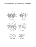 APPARATUS AND METHODS FOR POSITIONING AND SECURING ANCHORS diagram and image