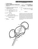 Methods for Anchoring Suture and Approximating Tissue diagram and image