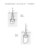 Methods for Anchoring Suture and Approximating Tissue diagram and image