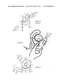 Methods for Anchoring Suture and Approximating Tissue diagram and image