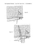 Methods for Anchoring Suture and Approximating Tissue diagram and image