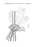 Methods for Anchoring Suture and Approximating Tissue diagram and image