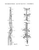 Methods for Anchoring Suture and Approximating Tissue diagram and image