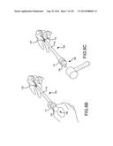 VERTEBRAL JOINT IMPLANTS AND DELIVERY TOOLS diagram and image