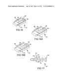 VERTEBRAL JOINT IMPLANTS AND DELIVERY TOOLS diagram and image