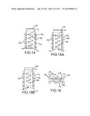 VERTEBRAL JOINT IMPLANTS AND DELIVERY TOOLS diagram and image