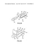 VERTEBRAL JOINT IMPLANTS AND DELIVERY TOOLS diagram and image