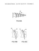 VERTEBRAL JOINT IMPLANTS AND DELIVERY TOOLS diagram and image