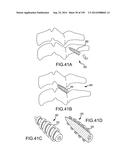 VERTEBRAL JOINT IMPLANTS AND DELIVERY TOOLS diagram and image