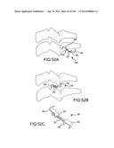 VERTEBRAL JOINT IMPLANTS AND DELIVERY TOOLS diagram and image