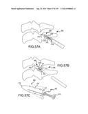 VERTEBRAL JOINT IMPLANTS AND DELIVERY TOOLS diagram and image