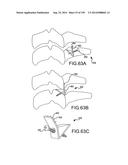 VERTEBRAL JOINT IMPLANTS AND DELIVERY TOOLS diagram and image