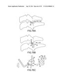 VERTEBRAL JOINT IMPLANTS AND DELIVERY TOOLS diagram and image