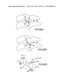 VERTEBRAL JOINT IMPLANTS AND DELIVERY TOOLS diagram and image