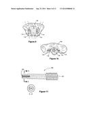 ODONTOID FRACTURE DYNAMIC COMPRESSION APPARATUS AND METHOD diagram and image