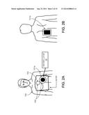 COORDINATED RESUSCITATION PERFUSION SUPPORT diagram and image