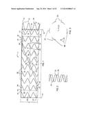 SYSTEM FOR IMPLANTING A PROSTHESIS diagram and image