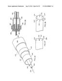 SYSTEM FOR IMPLANTING A PROSTHESIS diagram and image