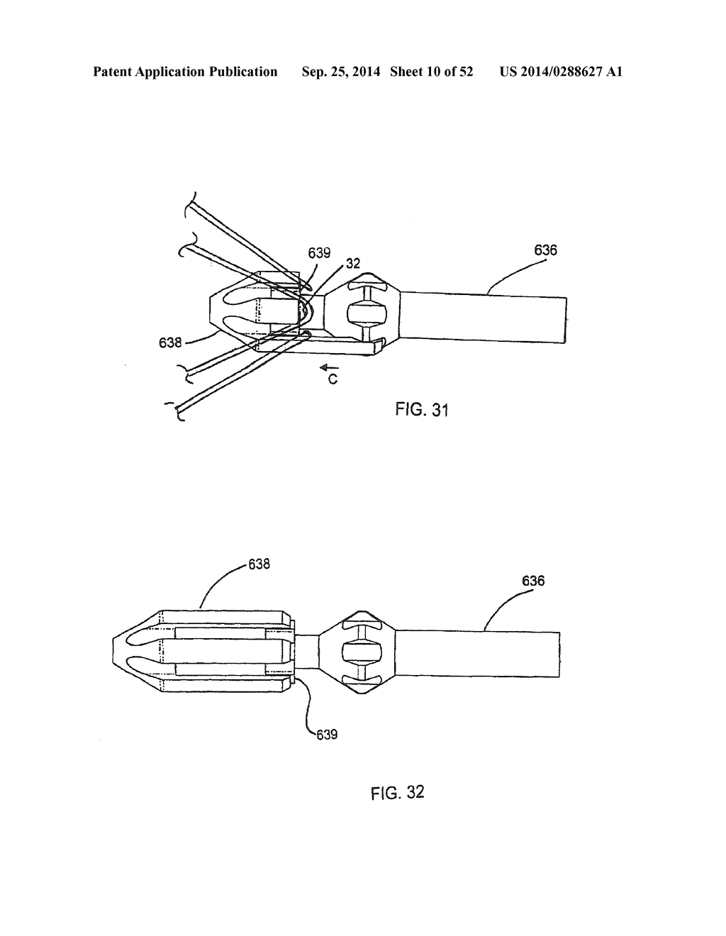 SYSTEM FOR IMPLANTING A PROSTHESIS - diagram, schematic, and image 11