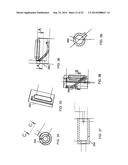 SYSTEM FOR IMPLANTING A PROSTHESIS diagram and image