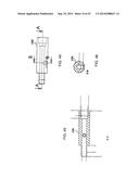 SYSTEM FOR IMPLANTING A PROSTHESIS diagram and image