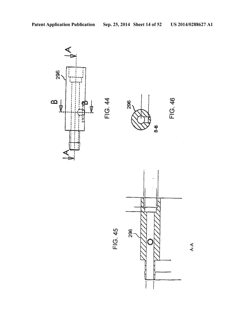 SYSTEM FOR IMPLANTING A PROSTHESIS - diagram, schematic, and image 15