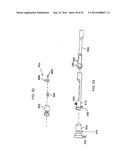 SYSTEM FOR IMPLANTING A PROSTHESIS diagram and image