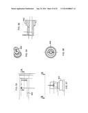 SYSTEM FOR IMPLANTING A PROSTHESIS diagram and image