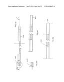 SYSTEM FOR IMPLANTING A PROSTHESIS diagram and image