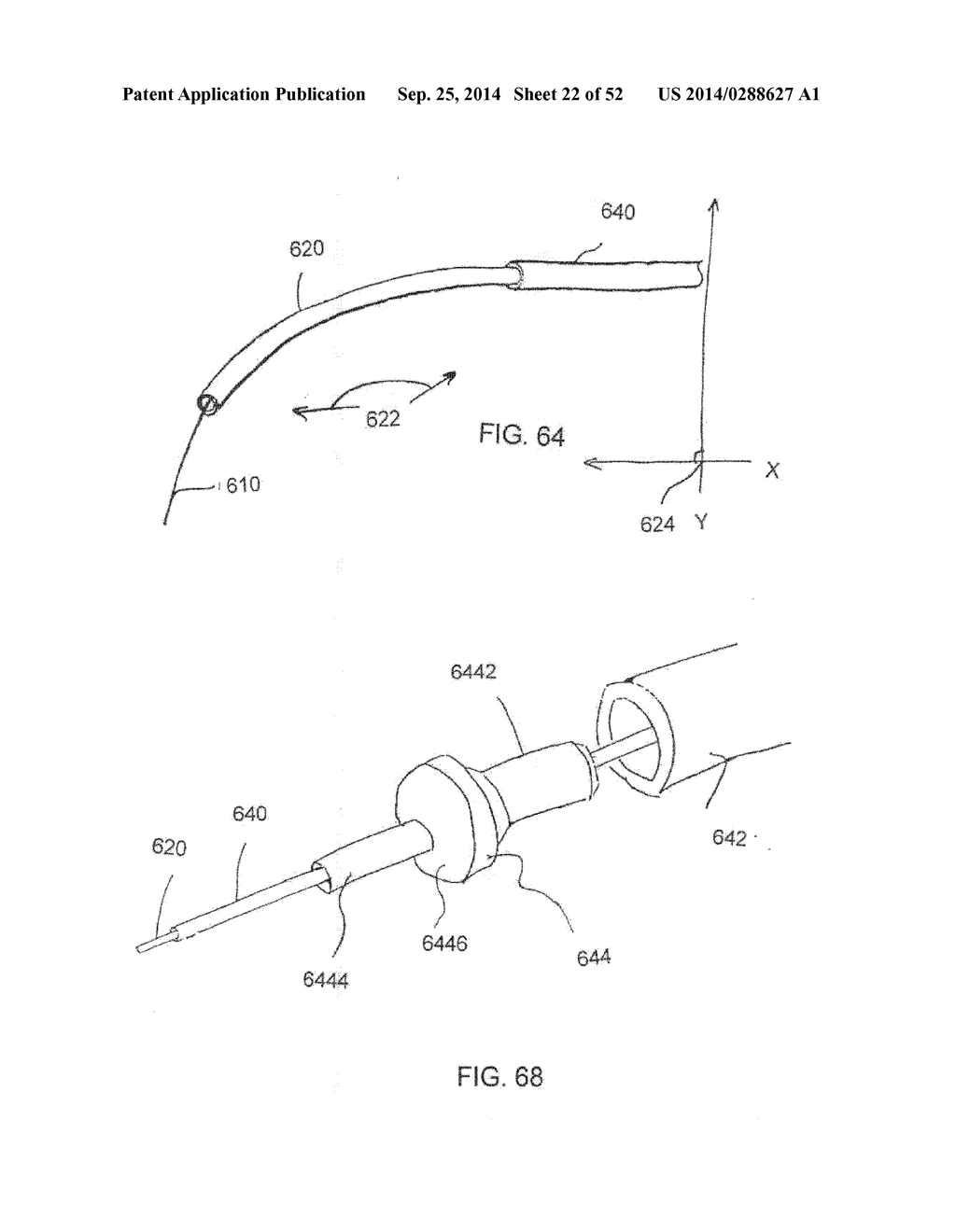 SYSTEM FOR IMPLANTING A PROSTHESIS - diagram, schematic, and image 23