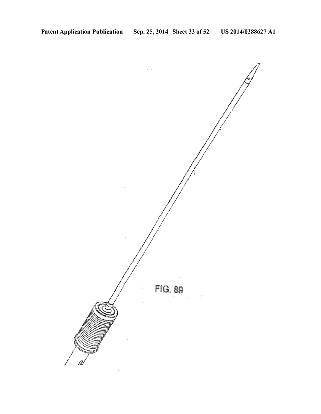 SYSTEM FOR IMPLANTING A PROSTHESIS - diagram, schematic, and image 34