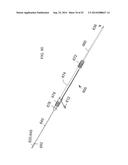 SYSTEM FOR IMPLANTING A PROSTHESIS diagram and image