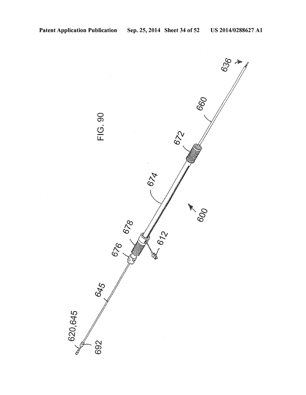 SYSTEM FOR IMPLANTING A PROSTHESIS - diagram, schematic, and image 35