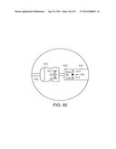 SYSTEM FOR IMPLANTING A PROSTHESIS diagram and image