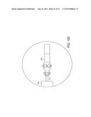 SYSTEM FOR IMPLANTING A PROSTHESIS diagram and image