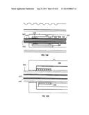 SYSTEM FOR IMPLANTING A PROSTHESIS diagram and image