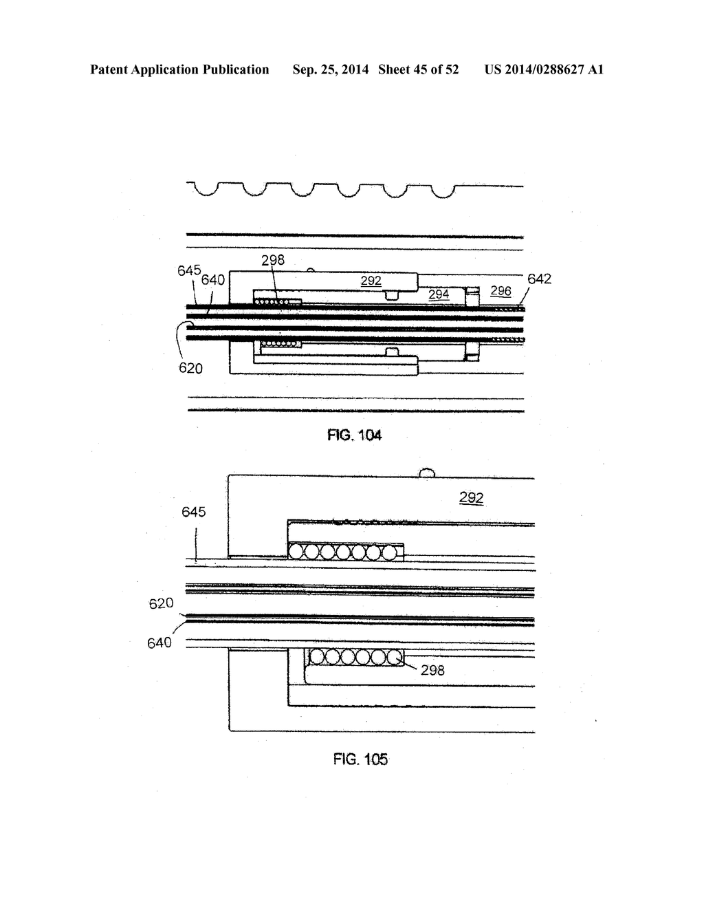 SYSTEM FOR IMPLANTING A PROSTHESIS - diagram, schematic, and image 46