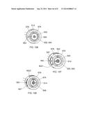 SYSTEM FOR IMPLANTING A PROSTHESIS diagram and image