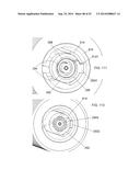 SYSTEM FOR IMPLANTING A PROSTHESIS diagram and image