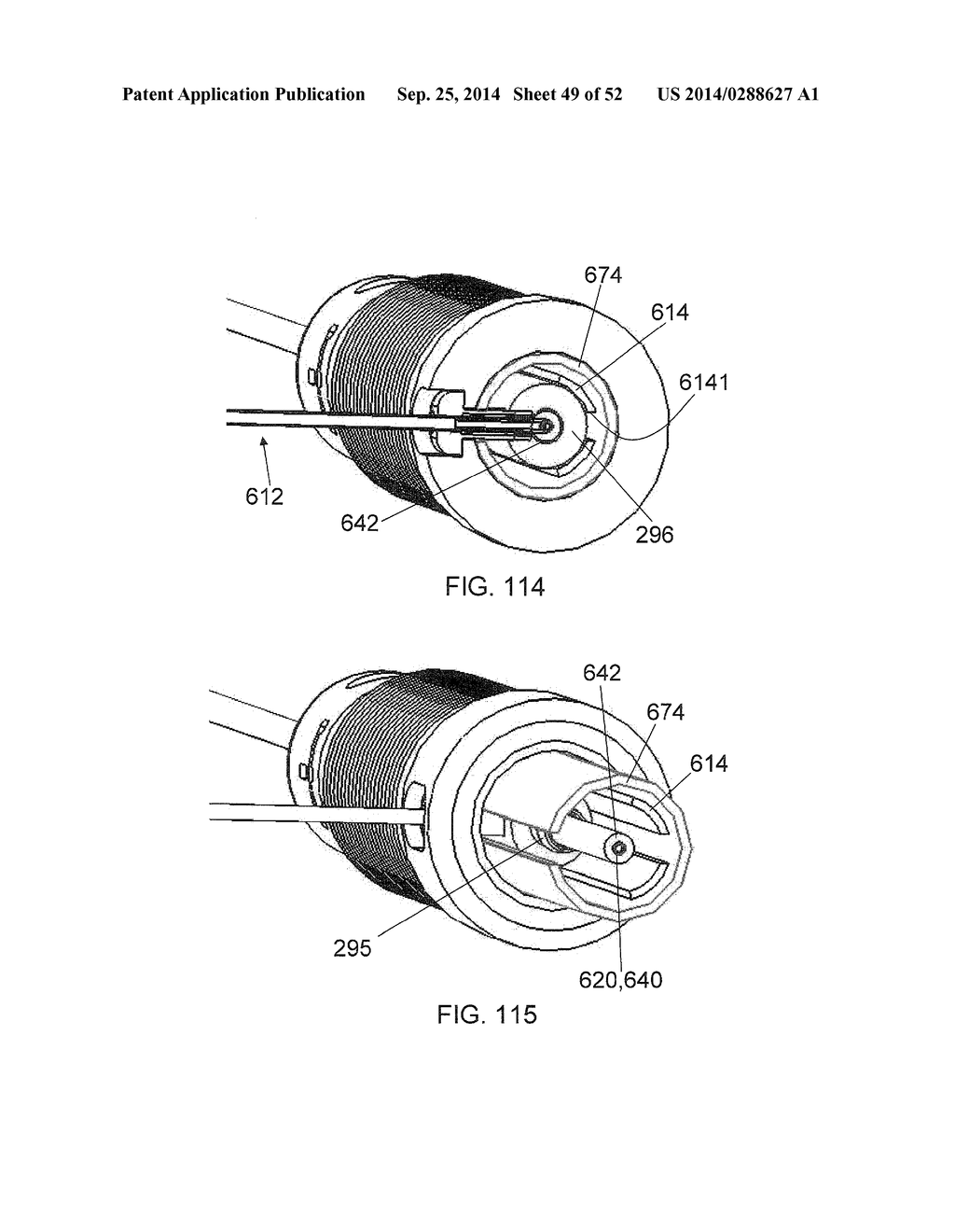 SYSTEM FOR IMPLANTING A PROSTHESIS - diagram, schematic, and image 50