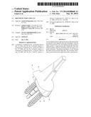 Prosthetic Wrist Implant diagram and image