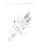 Prosthetic Wrist Implant diagram and image