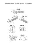 Prosthetic Wrist Implant diagram and image