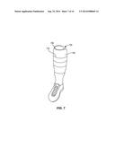 Limb Volume Accommodation in People With Limb Amputation diagram and image