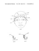 SWEAT DIVERTER diagram and image