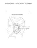 Headgear diagram and image