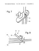 STABILIZING APPARATUS FOR INCLINED LEGS diagram and image