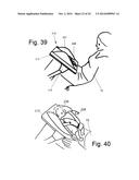 STABILIZING APPARATUS FOR INCLINED LEGS diagram and image